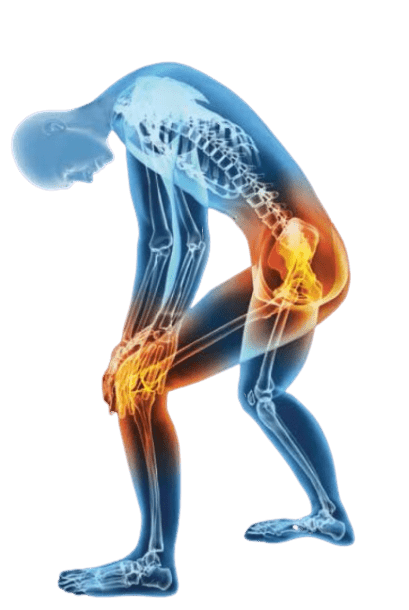 Osteoporosis Treatment In Gwalior