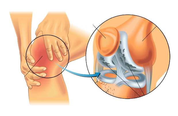 Joint Pain Treatment in Gwalior