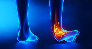 What Are The Types and Causes Of Leg Pain