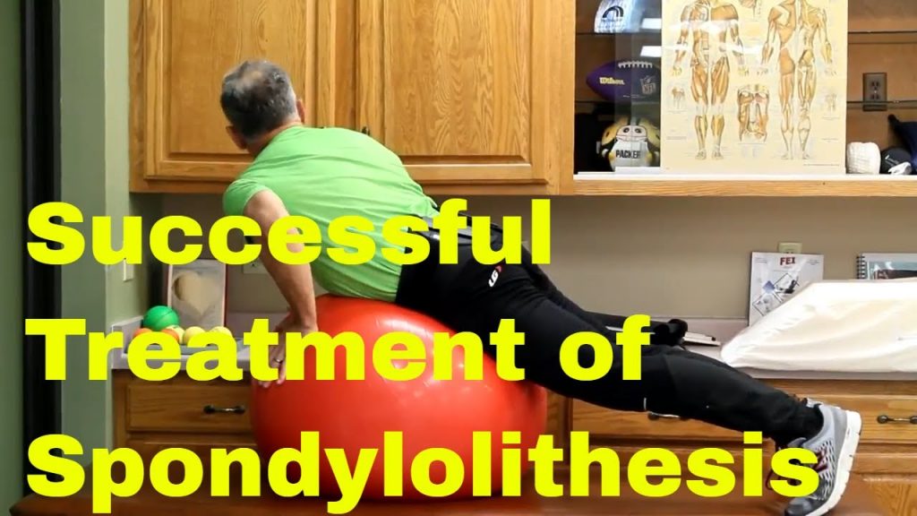Treatment for Spondylolisthesis without Surgery