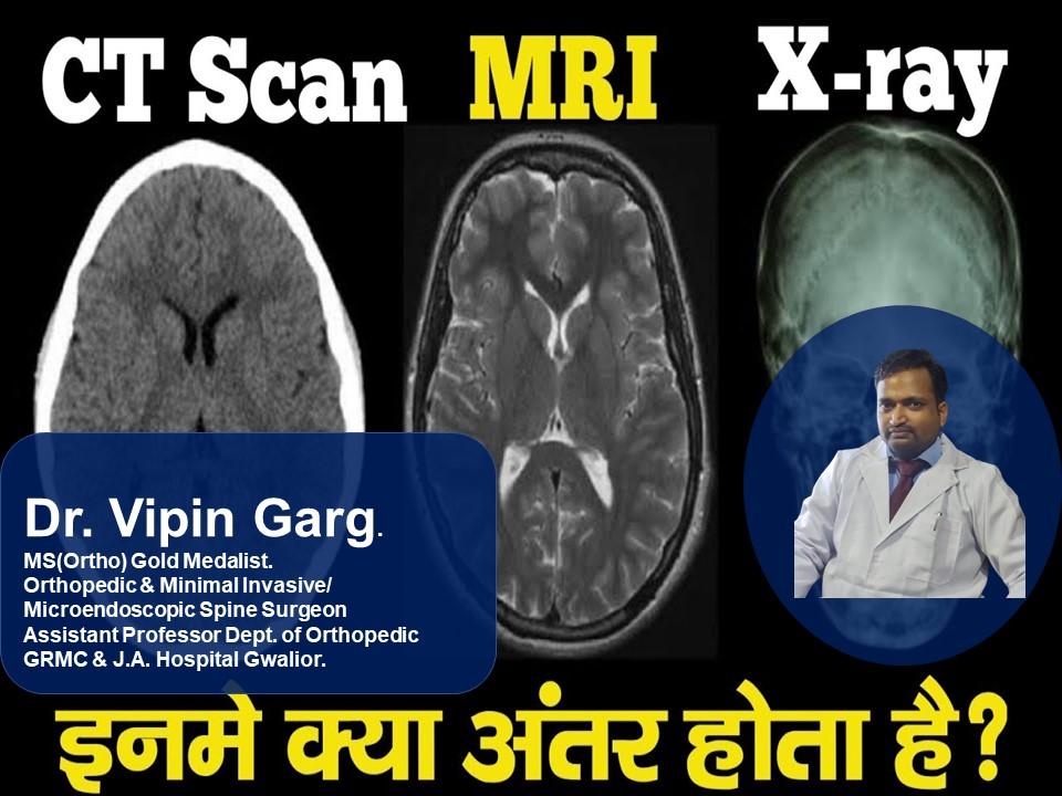 Differences Between MRIs and X-Rays and CT Scans