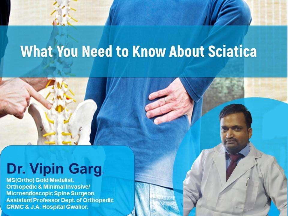 What You Need to Know About Sciatica