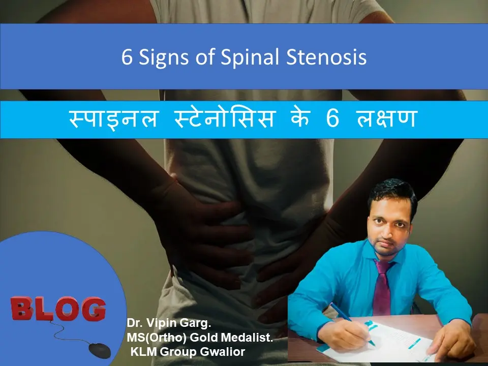 6 Signs of Spinal Stenosis
