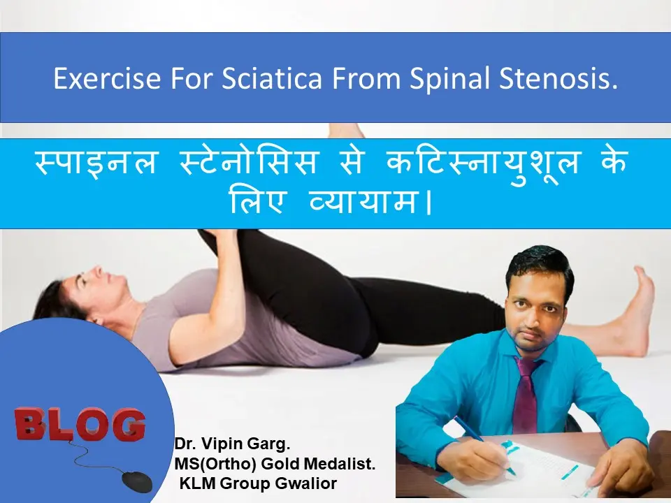 Exercise For Sciatica From Spinal Stenosis.