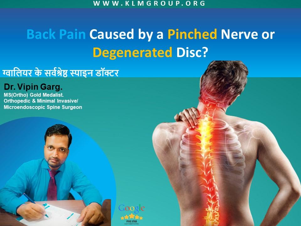 Back Pain Caused by a Pinched Nerve