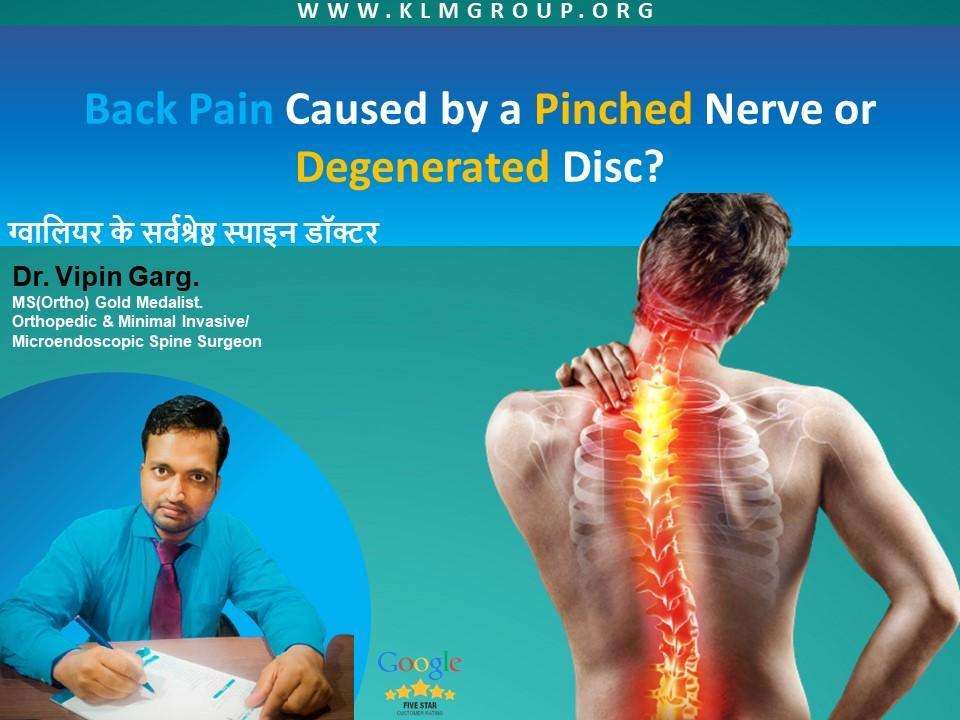 Back Pain Caused by a Pinched Nerve