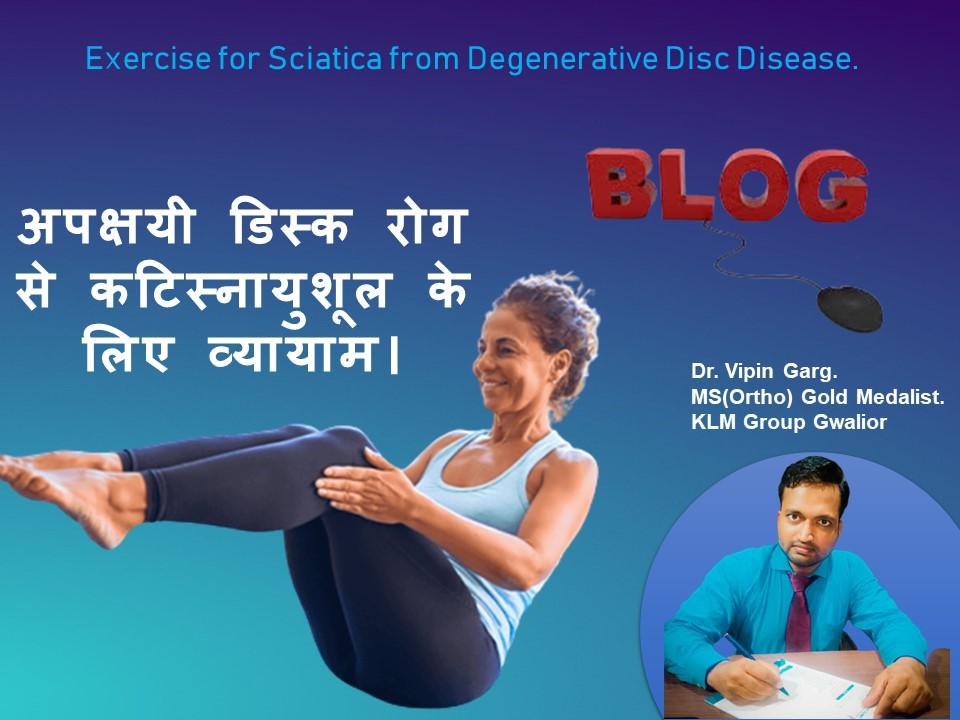 Exercise for Sciatica from Degenerative Disc Disease