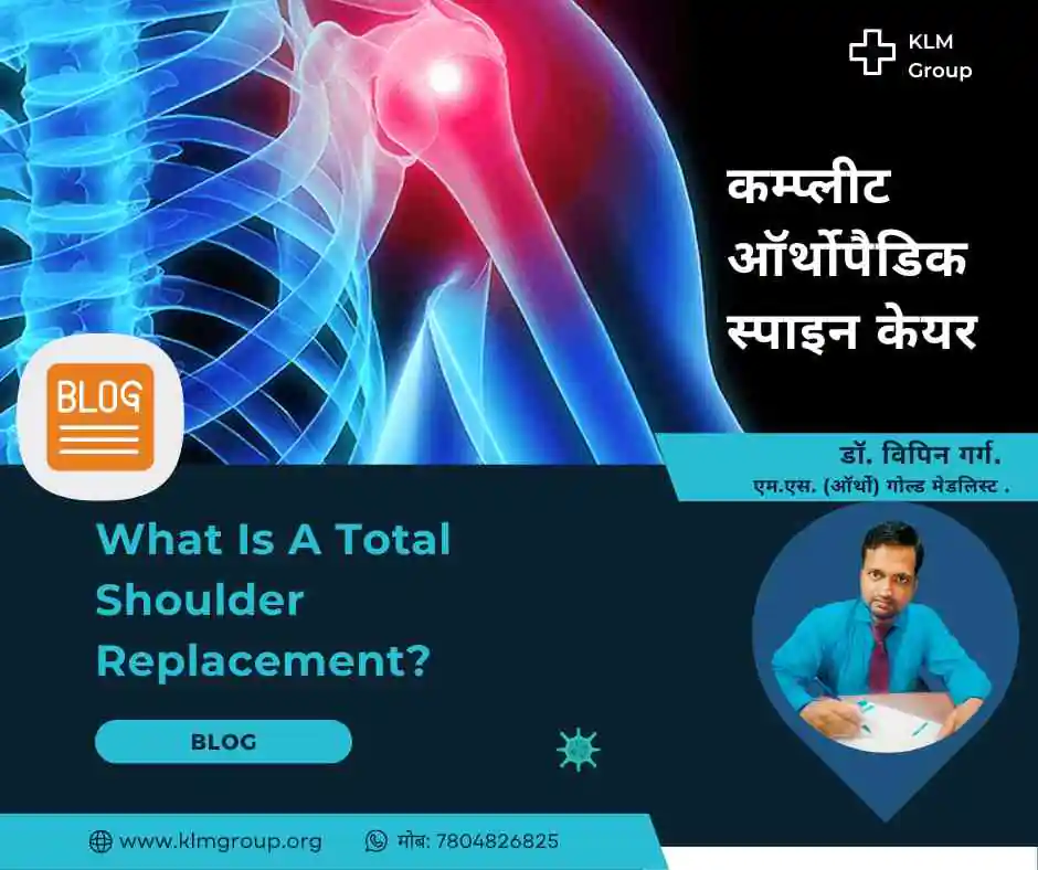 What Is A Total Shoulder Replacement