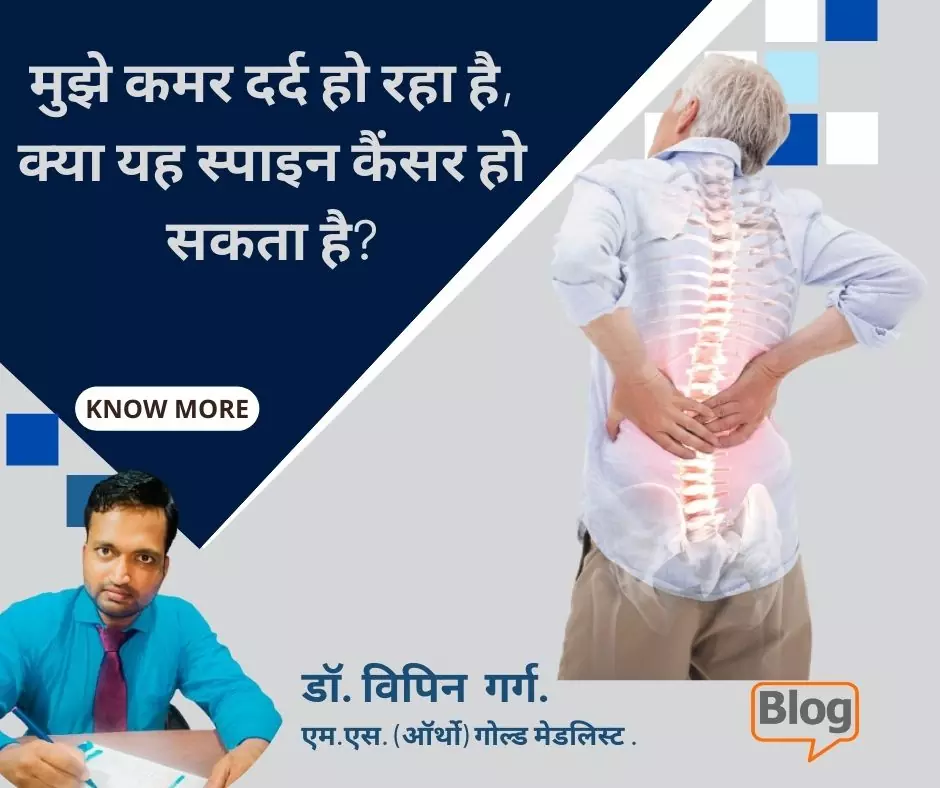 Back Pain Could It Be Spine Cancer