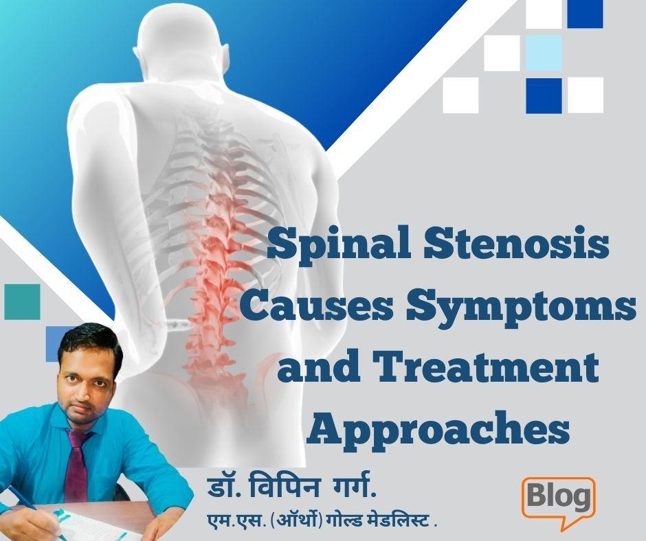 Spinal Stenosis Causes Symptoms and Treatment Approaches