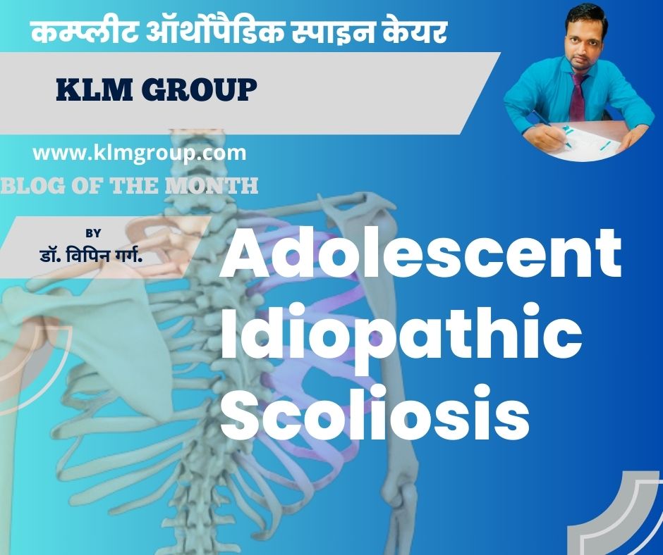 Adolescent Idiopathic Scoliosis